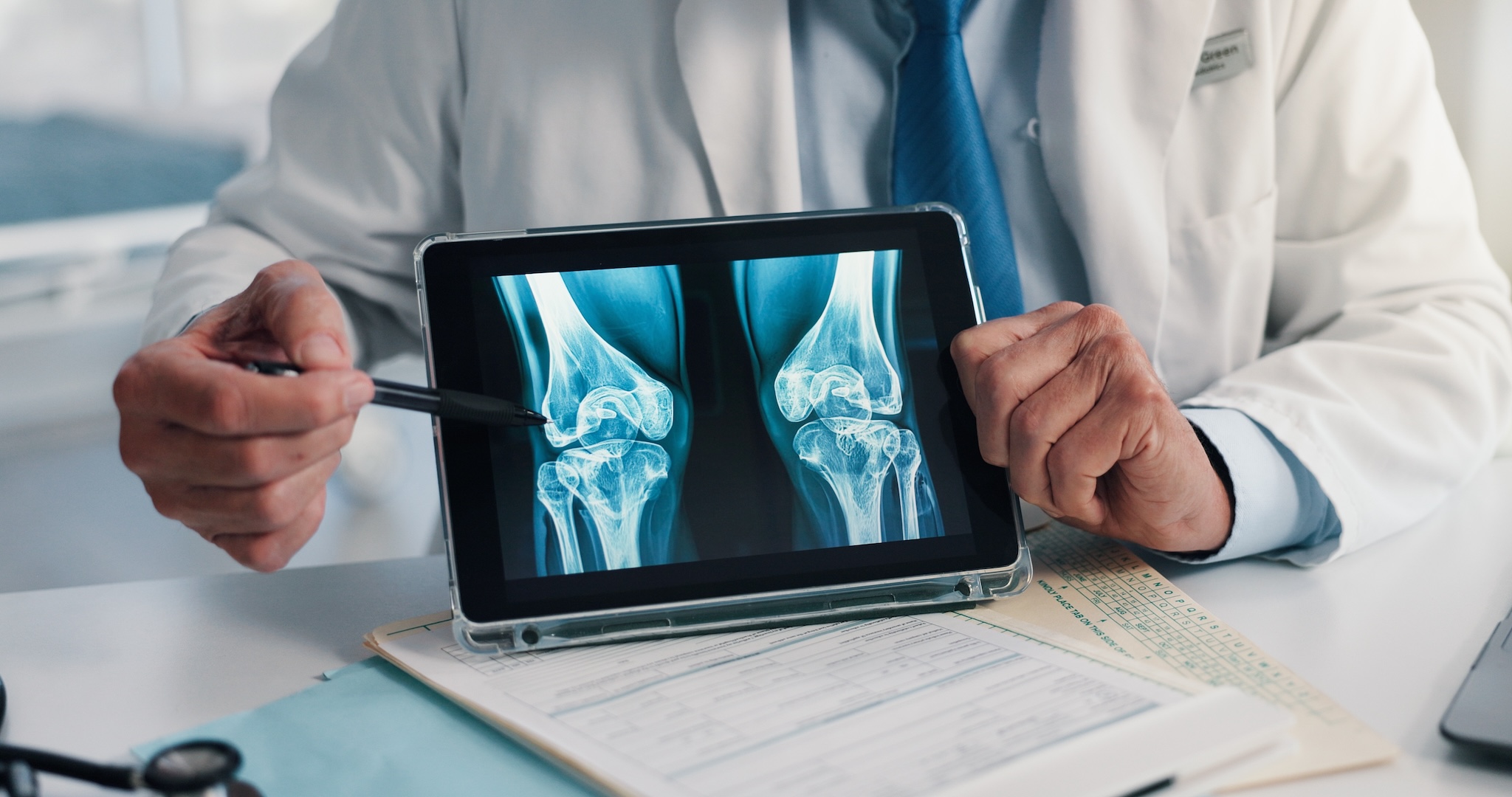 fast track orthopaedic consultation
